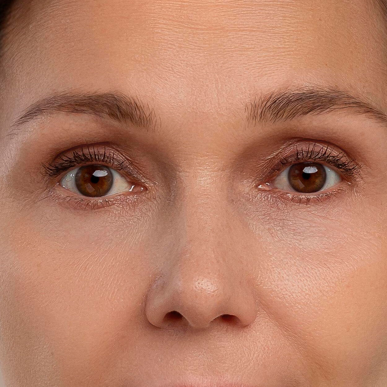 kırışıklık karşıtı