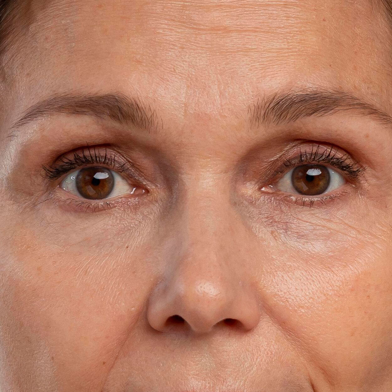 kırışıklık karşıtı